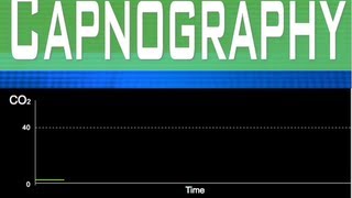 EtCO2 Capnography Part 3 [upl. by Quick]