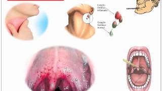 Streptococcus Pyogenes [upl. by Ayama]