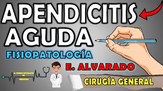 APENDICITIS AGUDA📝Fisiopatología SignosSíntomas y TratamientoESCALA DE ALVARADO Interpretación [upl. by Nnylyam]