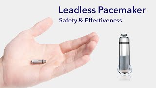 Cardiac Treatment Leadless Pacemakers [upl. by Asilrahc]