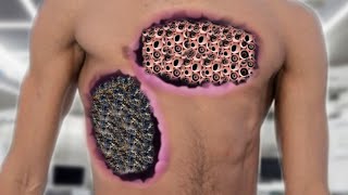 ASMR Inside Navel Maggots Remove  ASMR Belly Treatment Animation  ASMR 2d Gochdi MAN [upl. by Casia]