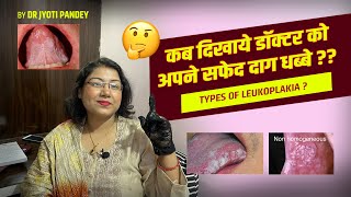 कब दिखाये डॉक्टर को अपने सफेद दाग धब्बे  Types of LEUKOPLAKIA… [upl. by Geralda]