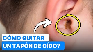 ¿Cómo Quitar un Tapón de Cera aceite de oliva velas 😮 [upl. by Diarmuid121]