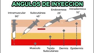 🔴 ANGULOS DE INYECCION INTRAMUSCULAR SUBCUTANEA INTRADERMICA Y ENDOVENOSA [upl. by Aitahs]