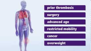 About Thrombosis Symptoms and risk factors for deep vein thrombosis DVT [upl. by Wadesworth]