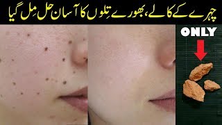 Remove Moles from FACE with this Simple Home Remedy Urdu Hindi [upl. by Garik]