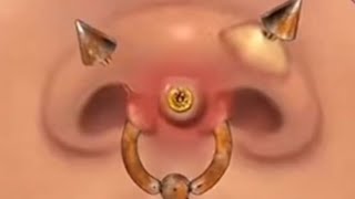 Nose cleaningnose ring cleaningpimple extraction trending animation satisfying asmr [upl. by Shina692]