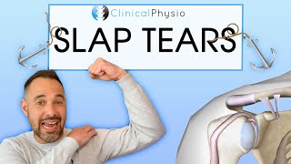 Superior Labral Anterior Posterior Tears  Everything you need to know about SLAP tears [upl. by Nyahs]