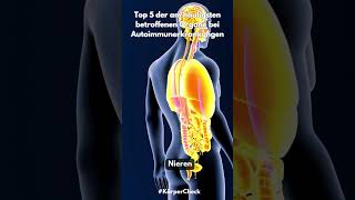 Top 5 der am häufigsten betroffenen Organe bei Autoimmunerkrankungen top5 autoimmunerkrankung [upl. by Dearborn]