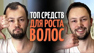 ТОП 5 средств для роста волос от врача дерматолога [upl. by Vincenty]