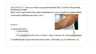 1er Cas Clinique Maladies Infectieuses conduite à tenir [upl. by Arrim]