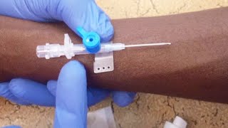 INTRAVENOUS CANNULATION TECHNIQUE  NURSING SKILLS PRACTICE [upl. by Naasar943]