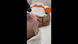 ANTI AGING TREATMENT TREATMENT BEAUTY ANTIAGING [upl. by Nyleikcaj]