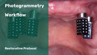 Photogrammetry Restorative Dental Workflow [upl. by Llerdnad135]