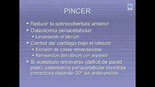 Lesion de Impingement o choque femoroacetabular [upl. by Akili]