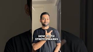 How to Fix Stretch Marks Fast with Bio Oil ✅ Proven Results amp Easy Tips shorts [upl. by Graehme]