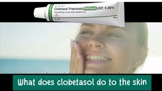 What does clobetasol do to the skin [upl. by Gaspard]