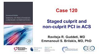 Case 120 PCI Manual Staged culprit and nonculprit PCI [upl. by Zeitler]