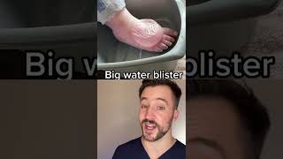 Dermatologist reacts to MASSIVE blister pop [upl. by Roda]