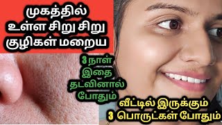 How to get rid of open pores at home in tamil natural ingredients jasvikamedia [upl. by Abdulla542]