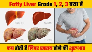 किसी भी स्टेज का फैटी लिवर ग्रेड 1 2 or 3 को ठीक कैसे करे  Fatty Liver Grades Explained in Hindi [upl. by Phip]