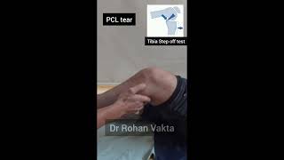 PCL tear tibia step off test [upl. by Arica]