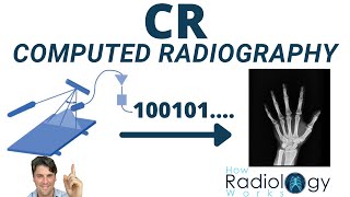 Computed Radiography How it Works CR Image Receptor [upl. by Adyahs]