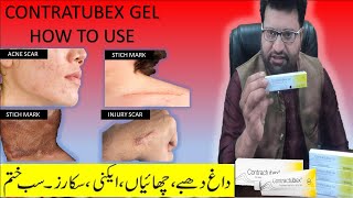 contractubex gel review  Acne scar removal cream  contractubex gel how to use  scar treatment gel [upl. by Kitarp]