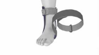 Bauerfeind MalleoLoc® Ankle Brace [upl. by Beitnes]