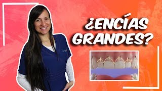 ¿Encías Grandes Tratamiento para sonrisa Gingival [upl. by Arihaz]