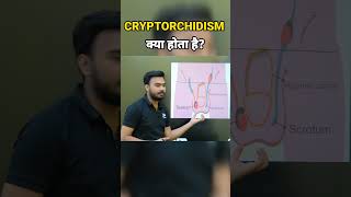 What Is Cryptorchidism  नपुंसकता कैसे होती है  shorts cryptorchidism biology xpclasses [upl. by Akerahs]