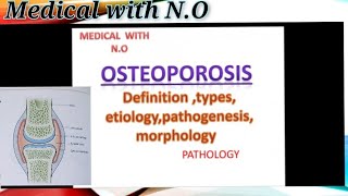 osteoporosis in hindiDEFINITION causes types pathogenesis morphology etc [upl. by Nnor]