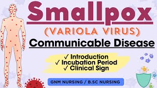 Smallpox Variola Virus  Communicable Disease [upl. by Ume]