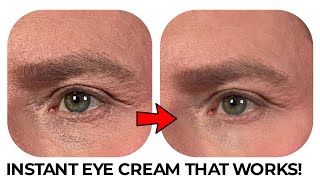 THE INSTANT EYE CREAM THAT WORKS IMMEDIATELY [upl. by Assel]