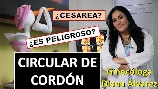 CIRCULAR DE CORDON POR GINECOLOGA DIANA ALVAREZ [upl. by Newo]