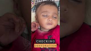 How to Check DEHYDRATION in babies dehydration babies diarrhea [upl. by Amehsat]