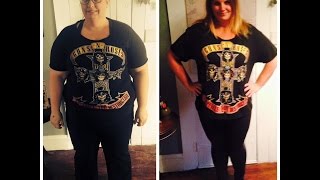 Vertical Gastric Sleeve  VSG  100 pounds down [upl. by Atnwahsal]