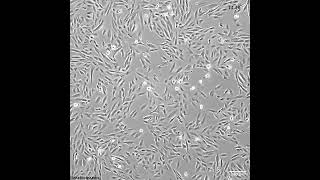 How quick do these melanoma cells grow [upl. by Negah]