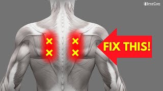 How to Fix Nerve Pain in the Shoulder Blades [upl. by Anaili]