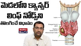 Neck Lymph Node Removal in Cancer Treatment  DrAvinash MedPlusONETV [upl. by Cynth460]