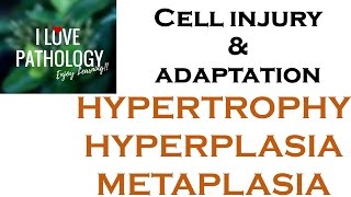 Cell Adaptations pathologyHYPERTROPHY HYPERPLASIA AND METAPLASIA [upl. by Atnwahs]