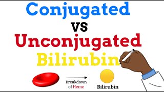 Conjugated vs Unconjugated Bilirubin  Simple Explanation [upl. by Crispen]