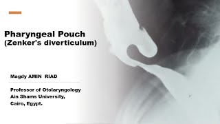 Pharyngeal Pouch  Zenkers diverticulum [upl. by Tiffanie493]