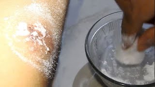 Most powerful home remedy for every purposes – BORIC ACIDPOWDER [upl. by Theobald262]