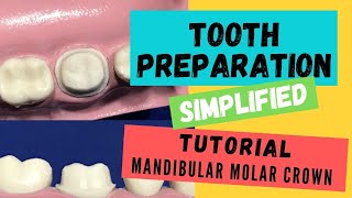 Zirconia Crown Preparation DEMONSTRATION Super Simplified [upl. by Eusoj66]