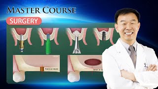 Master Course  SURGERY CAS Technique [upl. by Cavit]