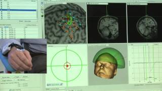 Robotic TMS Motor Mapping Over Predefined Grid [upl. by Aeriel679]