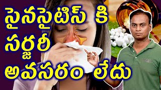 సైనసైటిస్ కి సర్జరీ అవసరం లేదు  Best homeopathy Treatment for Sinusitis  డా భరద్వాజ్  హోమియోపతి [upl. by Mokas]