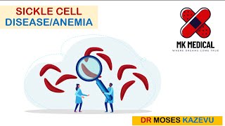 Sickle cell Anemia  SCA  SCD [upl. by Akemaj]