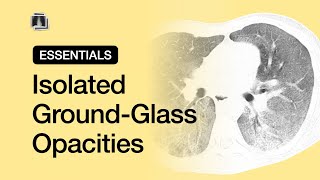 Isolated GroundGlass Opacities  Chest Radiology Essentials [upl. by Badr]